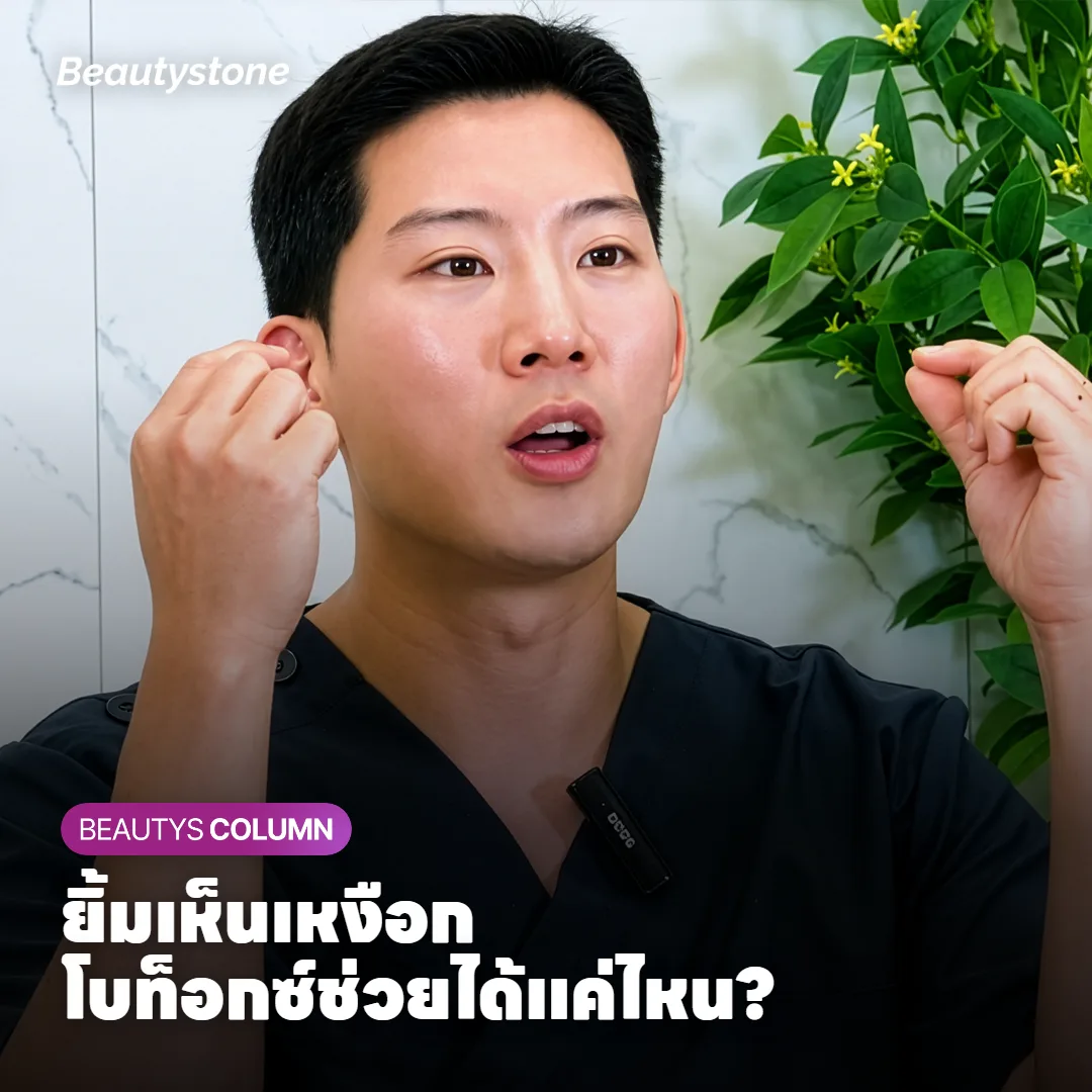 ยิ้มเห็นเหงือก ฉีดโบท็อกซ์แล้วเหงือกจะโผล่น้อยลงแค่ไหน?