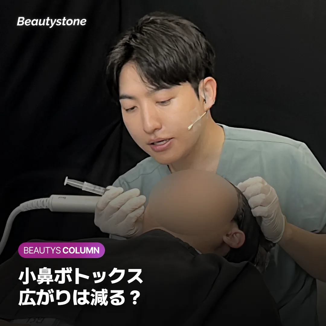 小鼻ボトックス、笑ったときの広がりは減る?