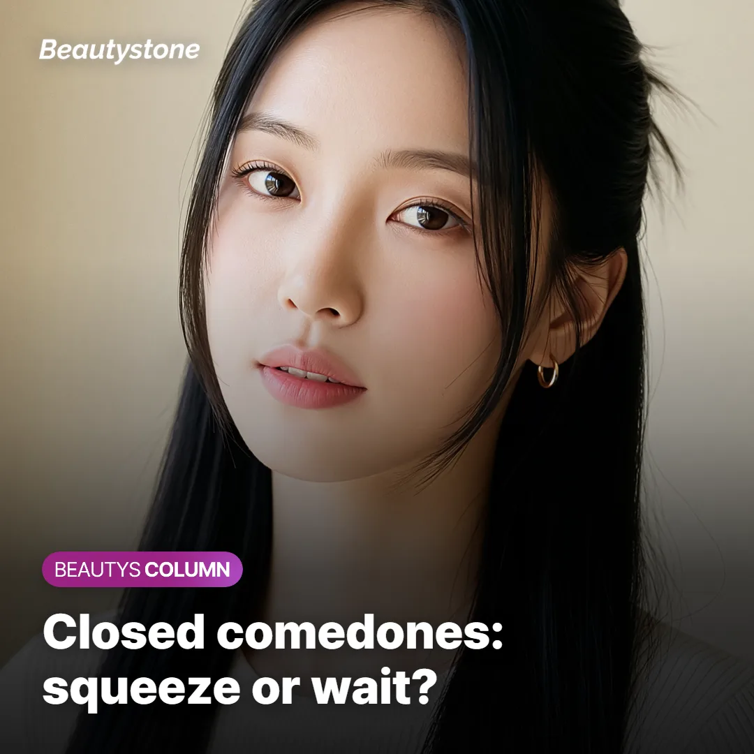 Closed Comedones: Squeeze Them or Wait It Out?