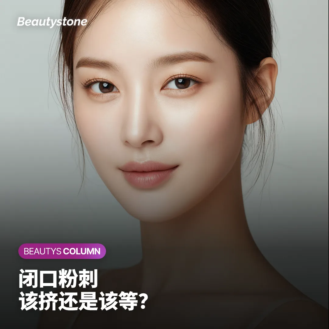 闭口粉刺挤不出来?外用药要涂几周才能看出效果
