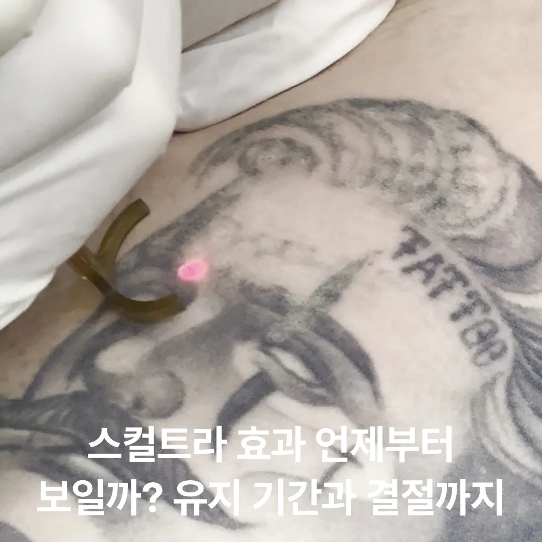 스컬트라 효과 언제부터 보일까? 유지 기간과 결절까지
