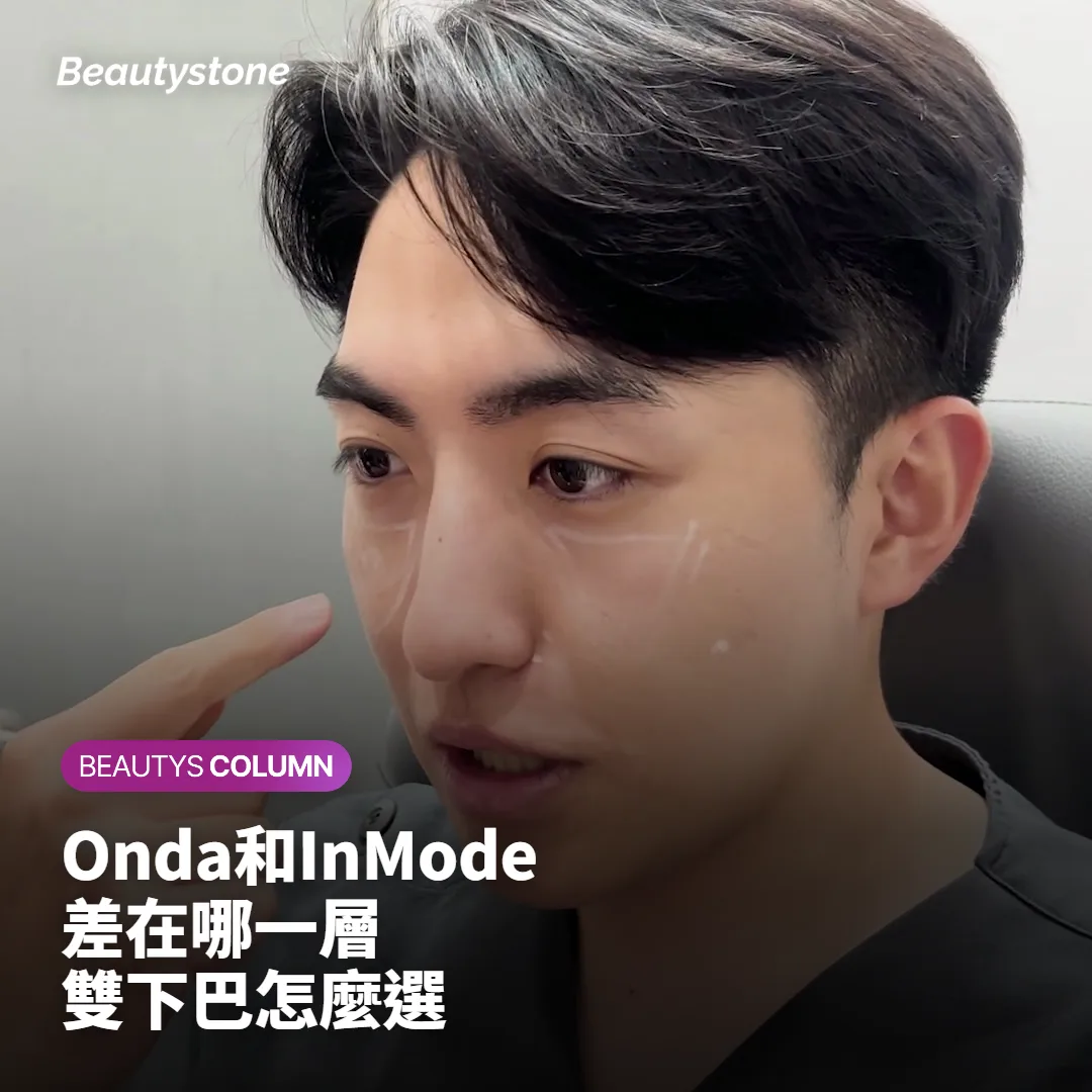 Onda和InMode差在哪?雙下巴、臉凹風險與首爾行程怎麼選