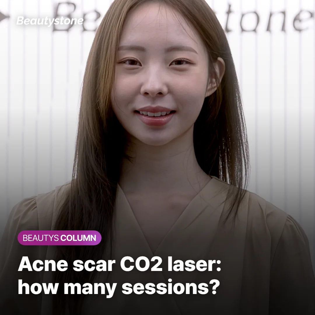 Acne Scar CO2 Laser: How Many Sessions?