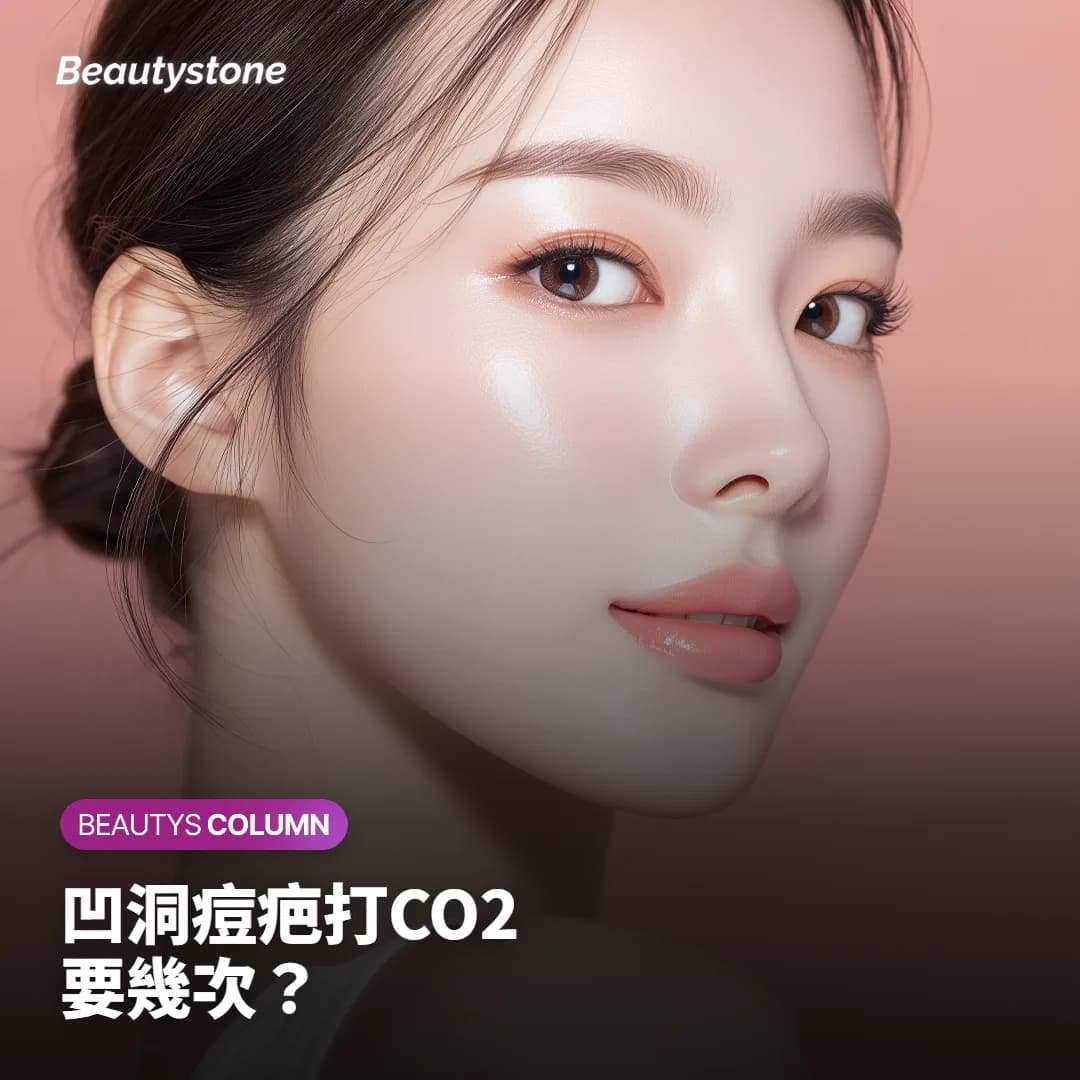 凹洞痘疤打CO2飛梭雷射,要幾次、能填平多少?