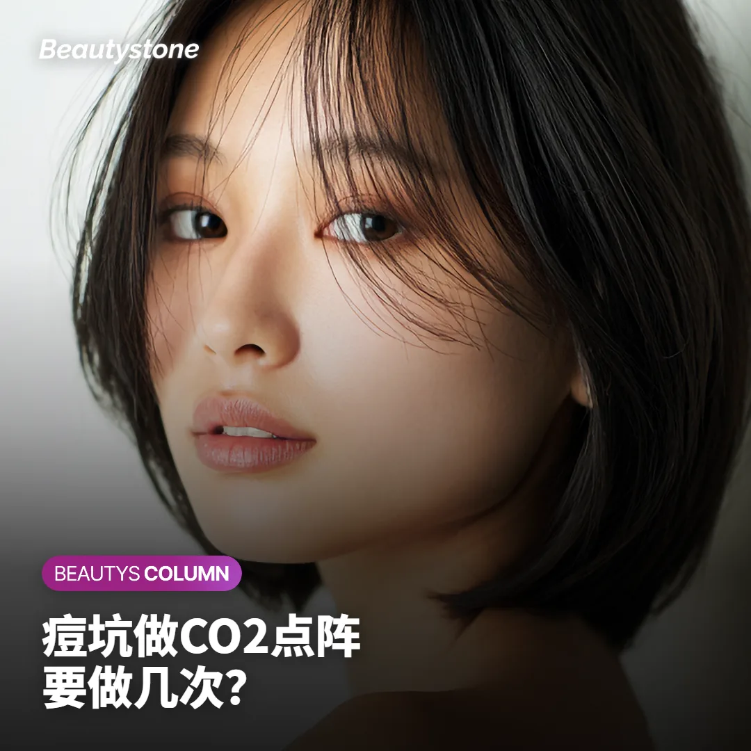 痘坑做CO2点阵激光,要做几次、能填平多少?