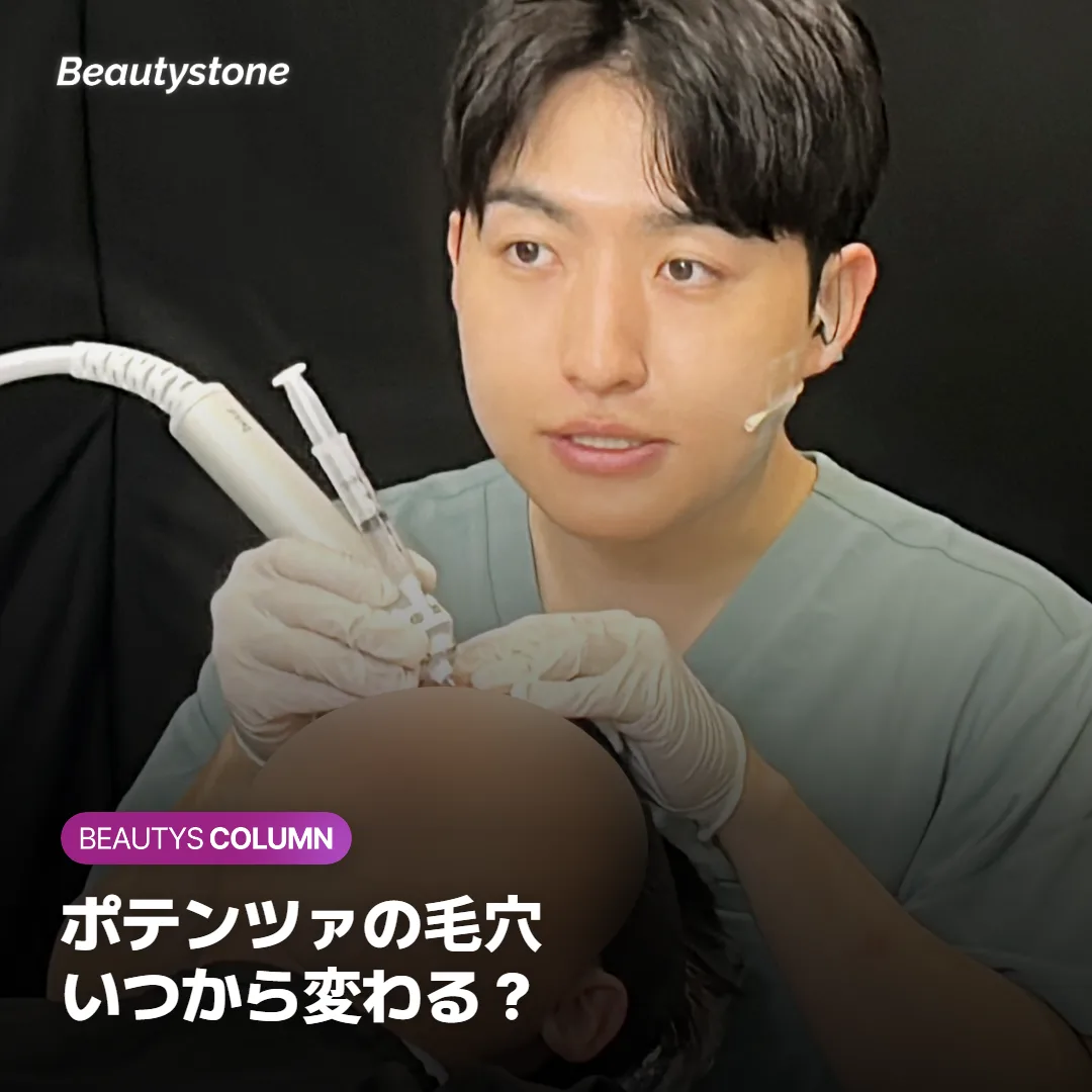 ポテンツァの効果はいつから?毛穴が変わって見える回数を解説