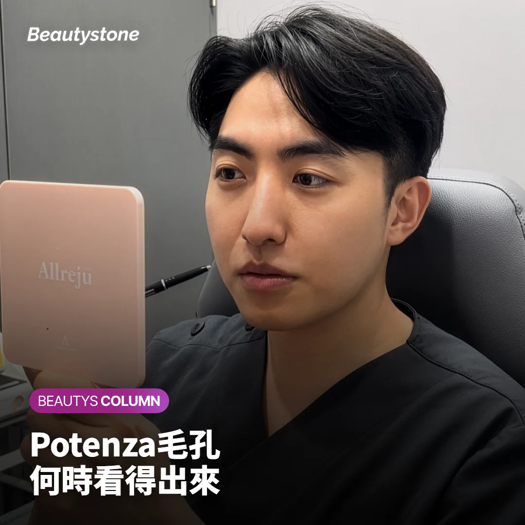 Potenza效果多久出現?毛孔要做到第幾次才看得出變化