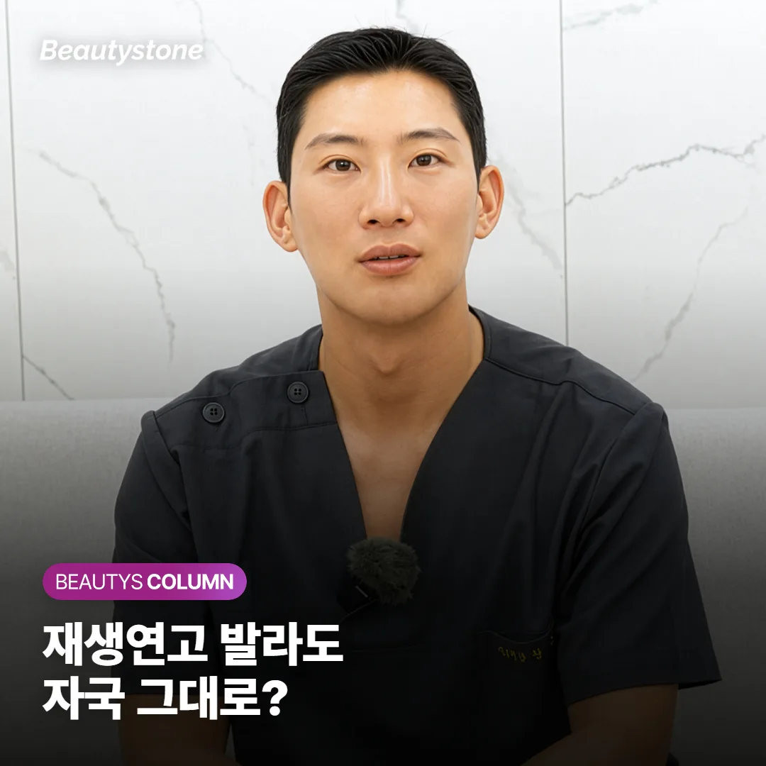 여드름 자국 재생연고, 바르면 옅어질까요? 연고로 안 되는 자국