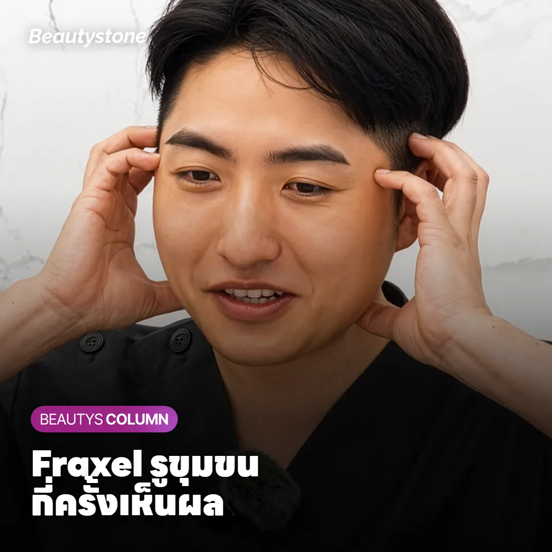 Fraxel รูขุมขน ทำกี่ครั้งถึงเห็นผล หลังครั้งแรกต้องรอดูนานแค่ไหน?