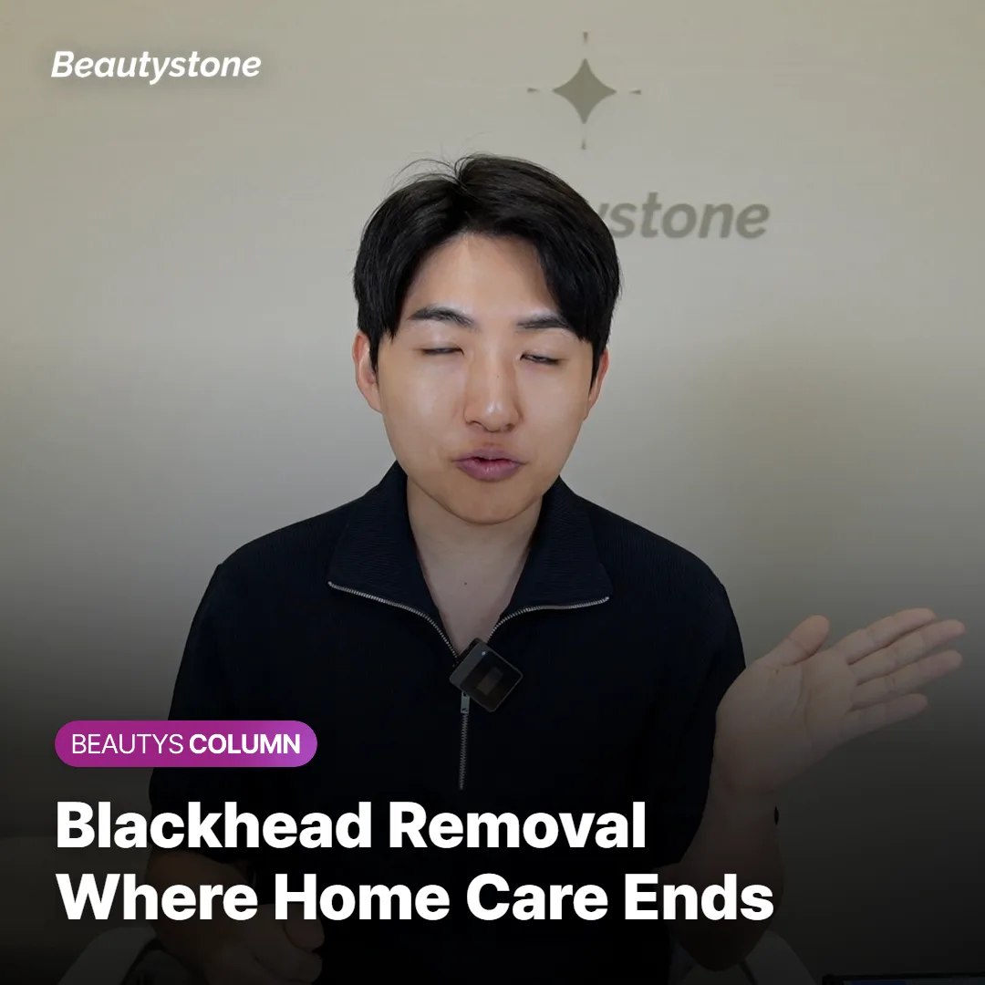 Blackhead Removal at Home: Why Wait 6–8 Weeks?