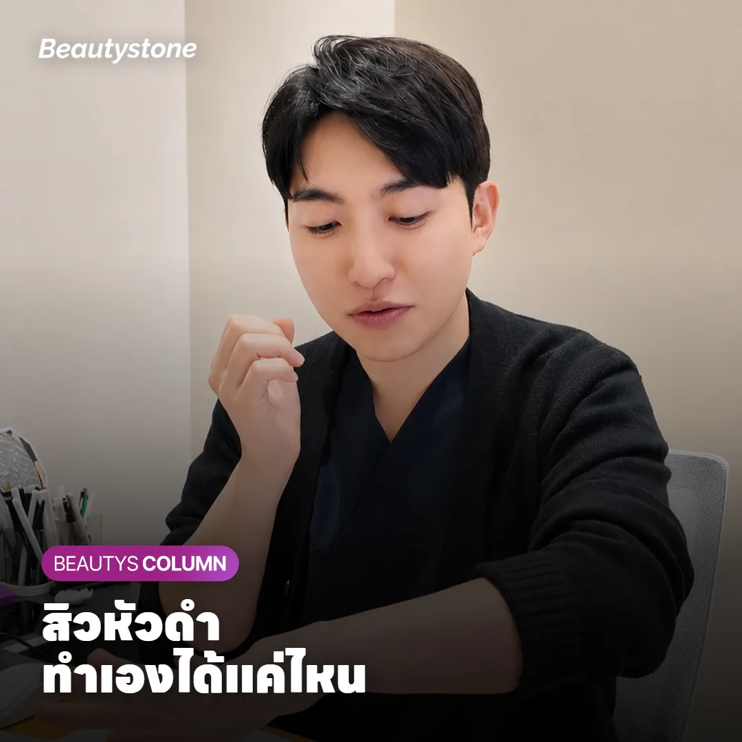 สิวหัวดำ ใช้แผ่นลอกสิวเสี้ยนหรือที่กดสิวเองที่บ้านได้ไหม?