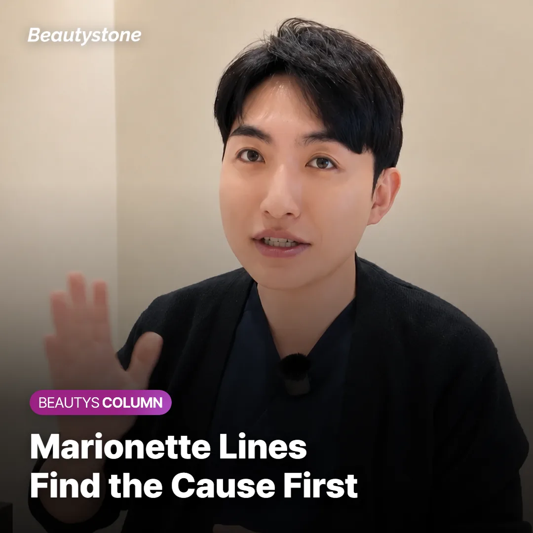 Marionette Lines: Filler, Botox or Lifting?