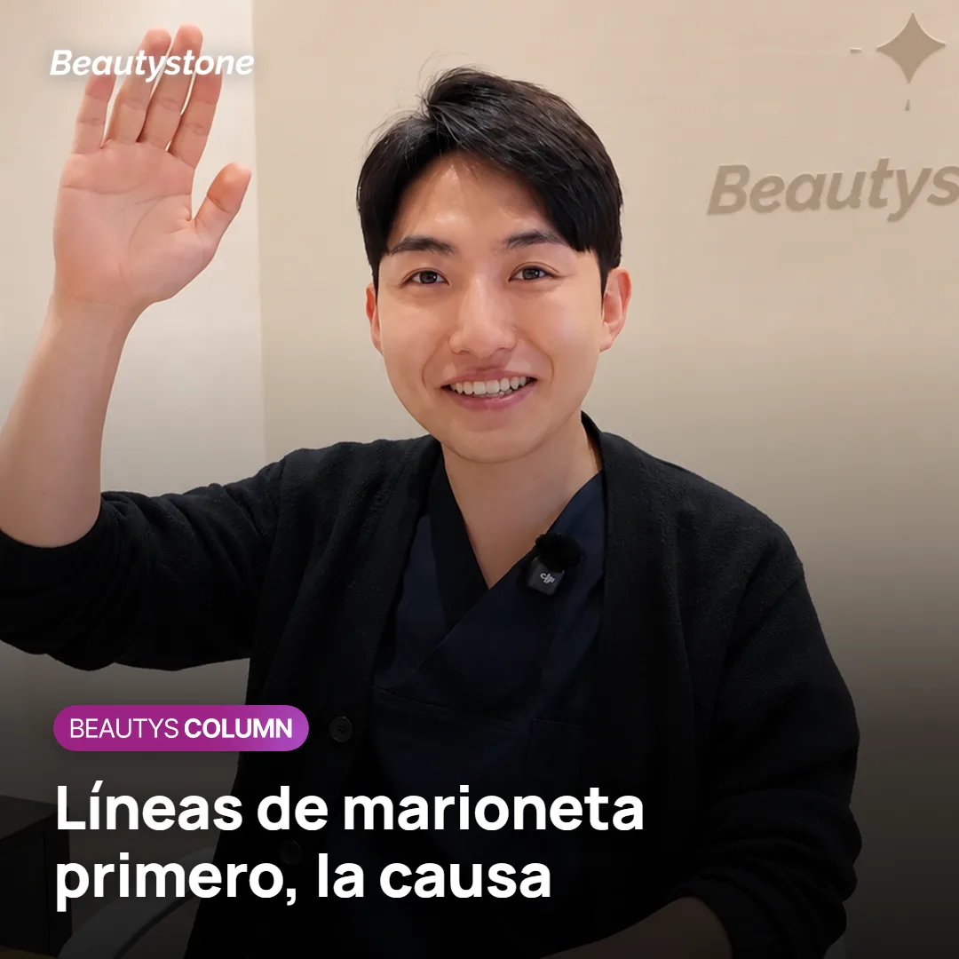 Líneas de marioneta: ¿relleno, bótox, lifting?