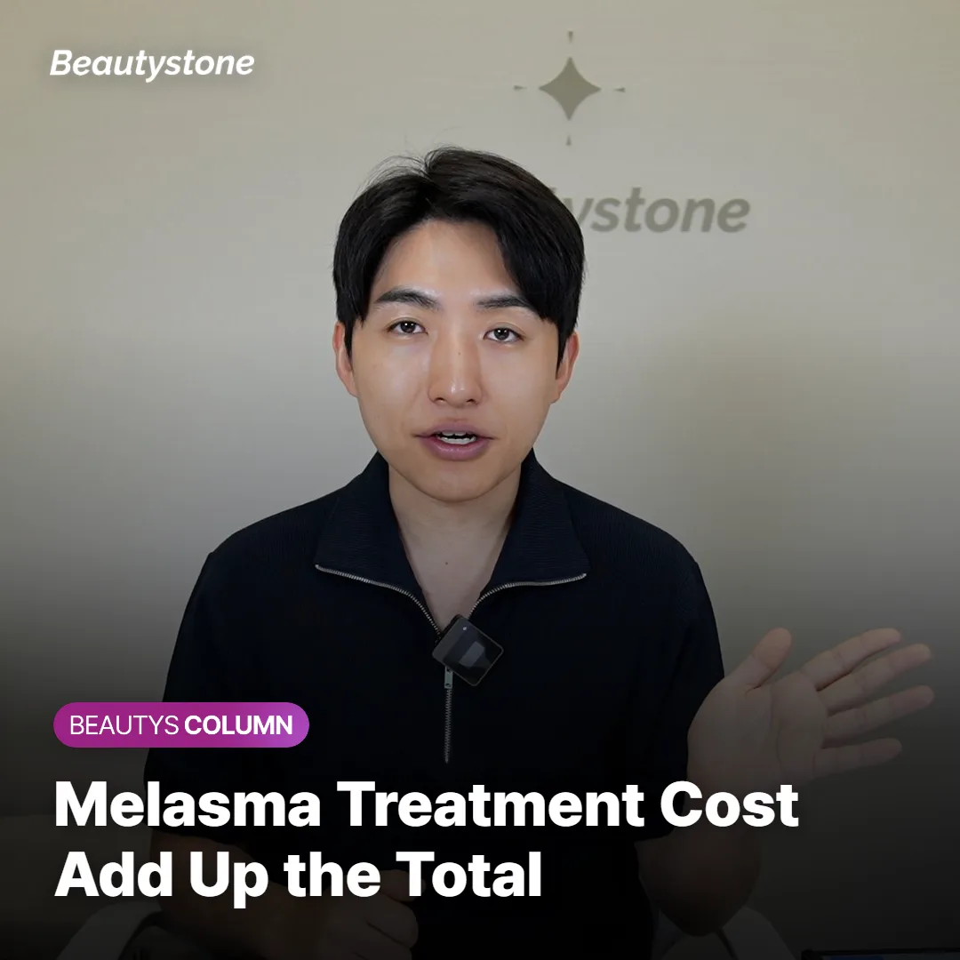Melasma Laser Treatment Cost: 5 Things to Add