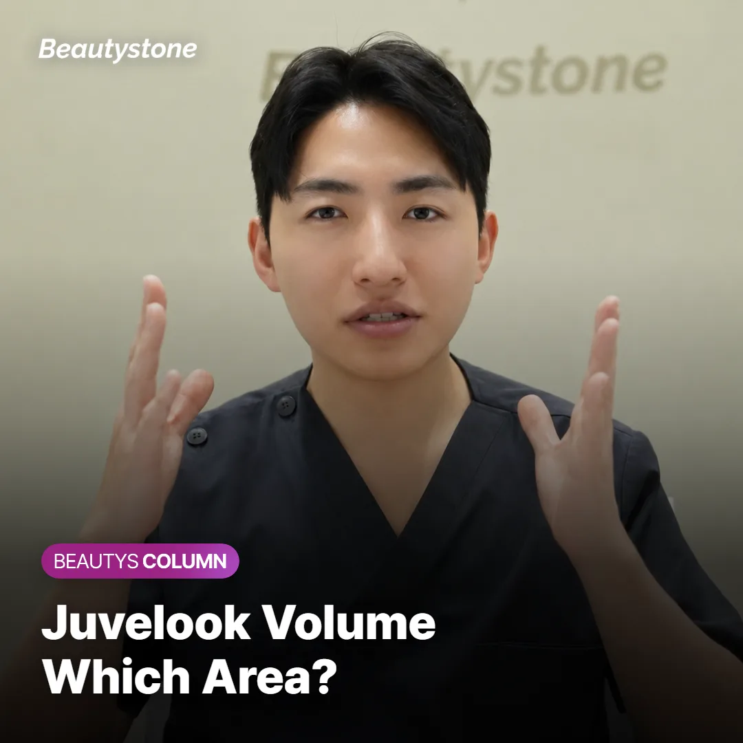 Juvelook Volume: Which of 3 Areas Fits Best?