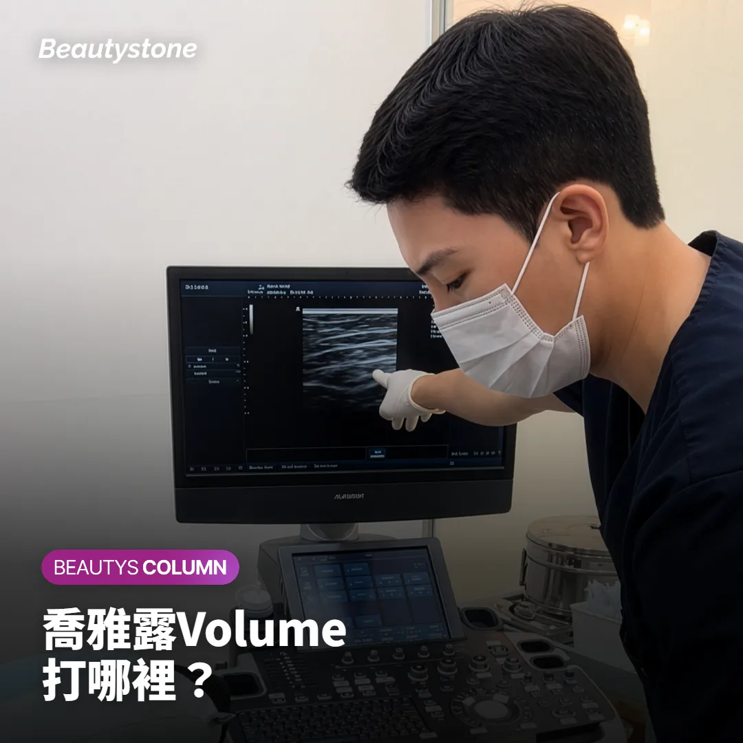喬雅露Volume打哪裡?顴骨下方、法令紋、眼下怎麼選