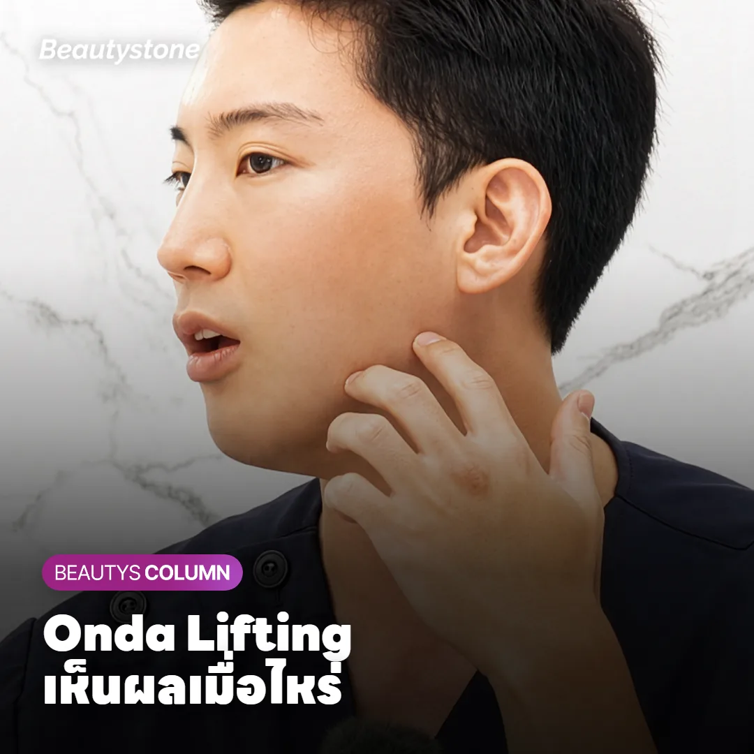 Onda Lifting เห็นผลเมื่อไหร่ ควรดูผลที่ 1 เดือนหรือ 3 เดือน?