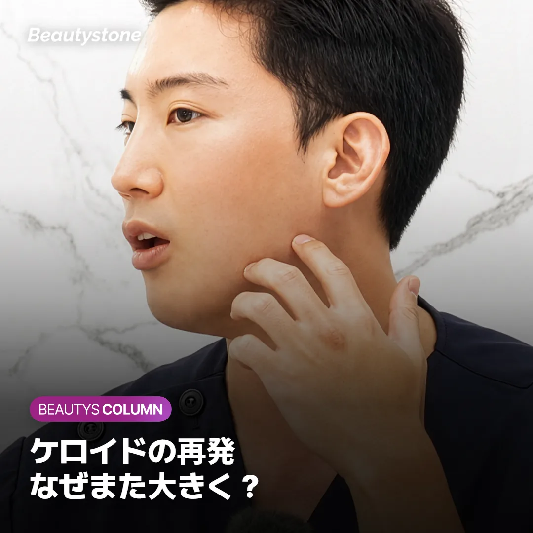 ケロイドの再発、注射で平らになったのになぜまた大きくなる?