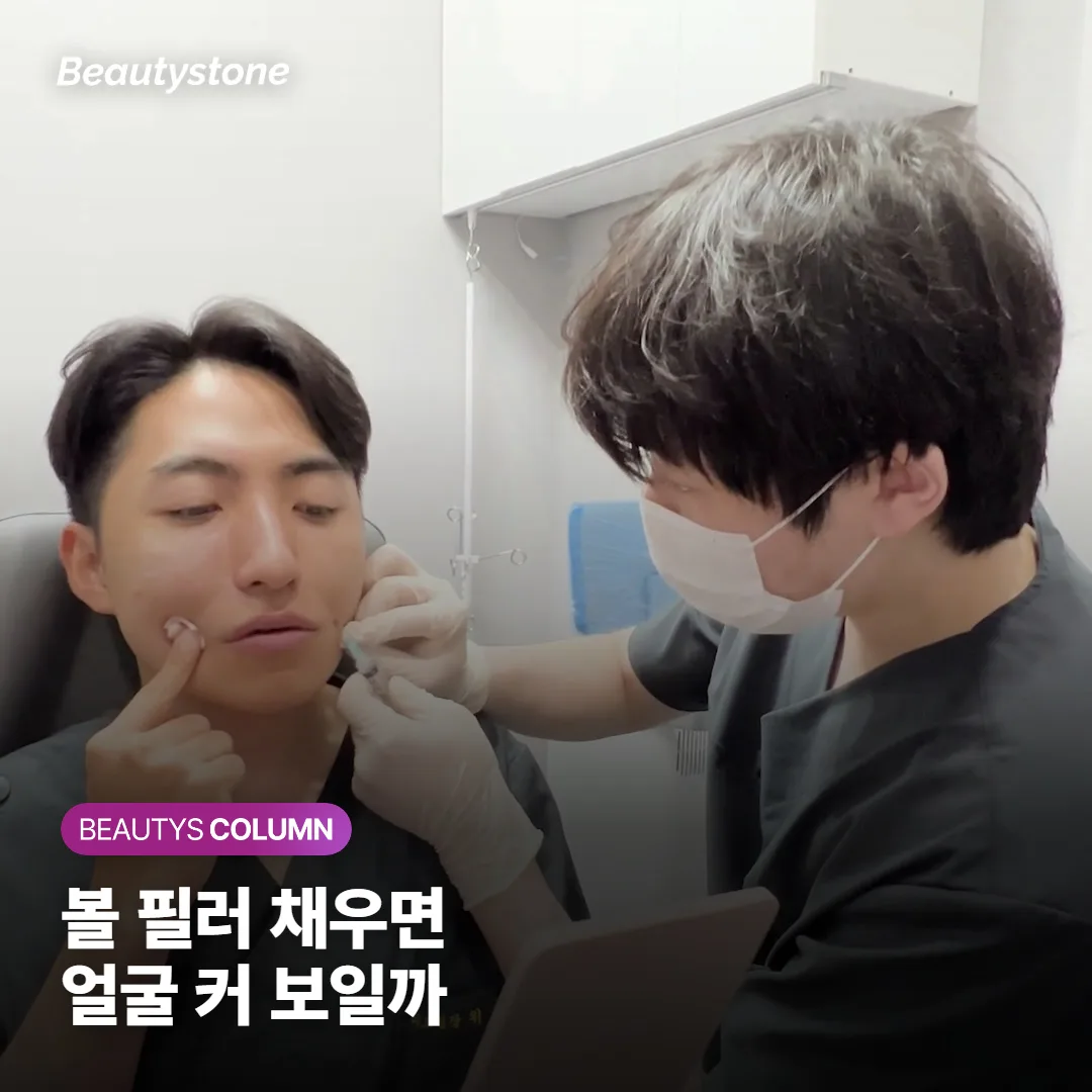 볼 필러, 꺼진 곳을 채우면 얼굴이 더 커 보일까요?