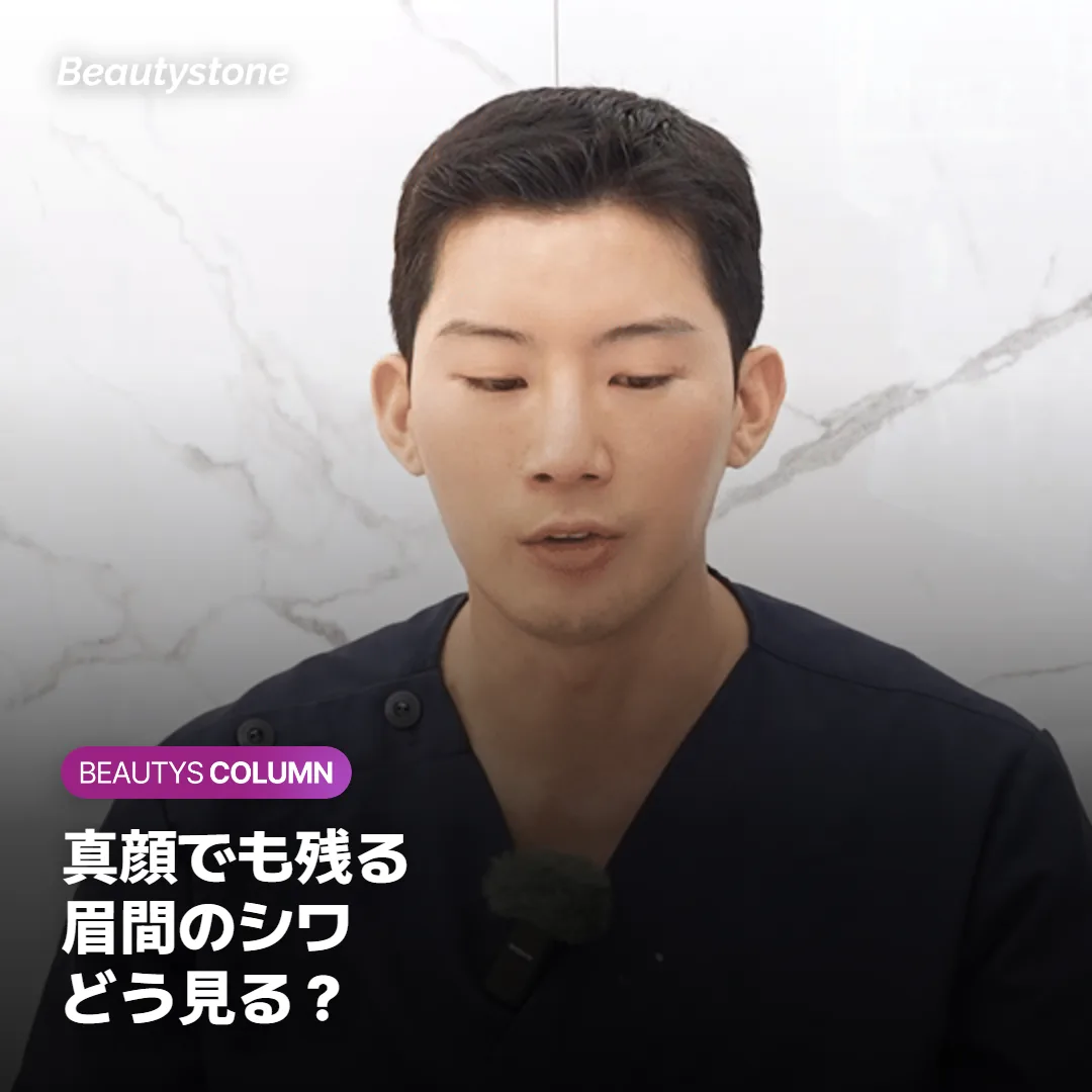 眉間ボトックスで真顔のシワは薄くなる?残るくぼみとフィラーの注意点