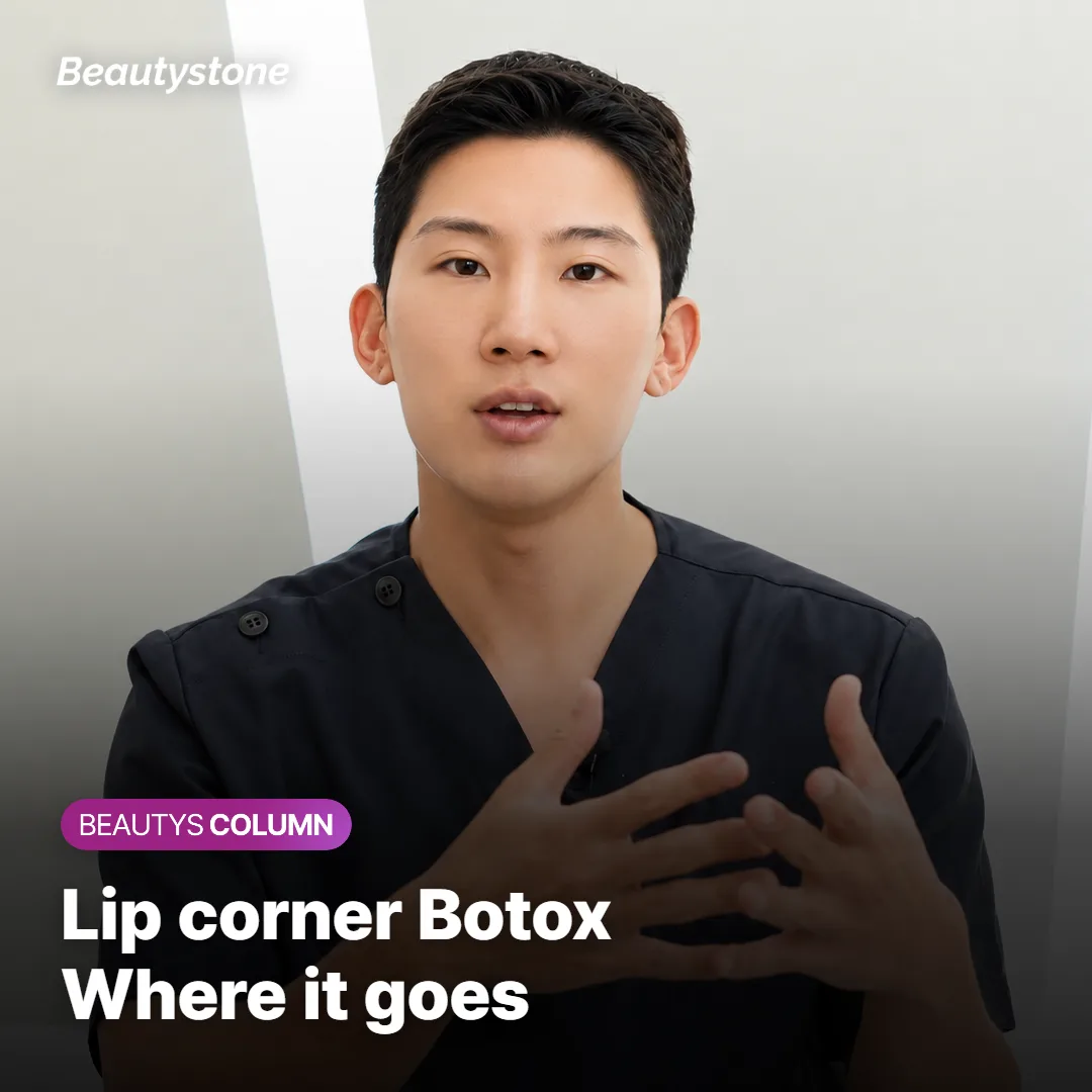 Lip Corner Botox: Where Do the Injections Go?