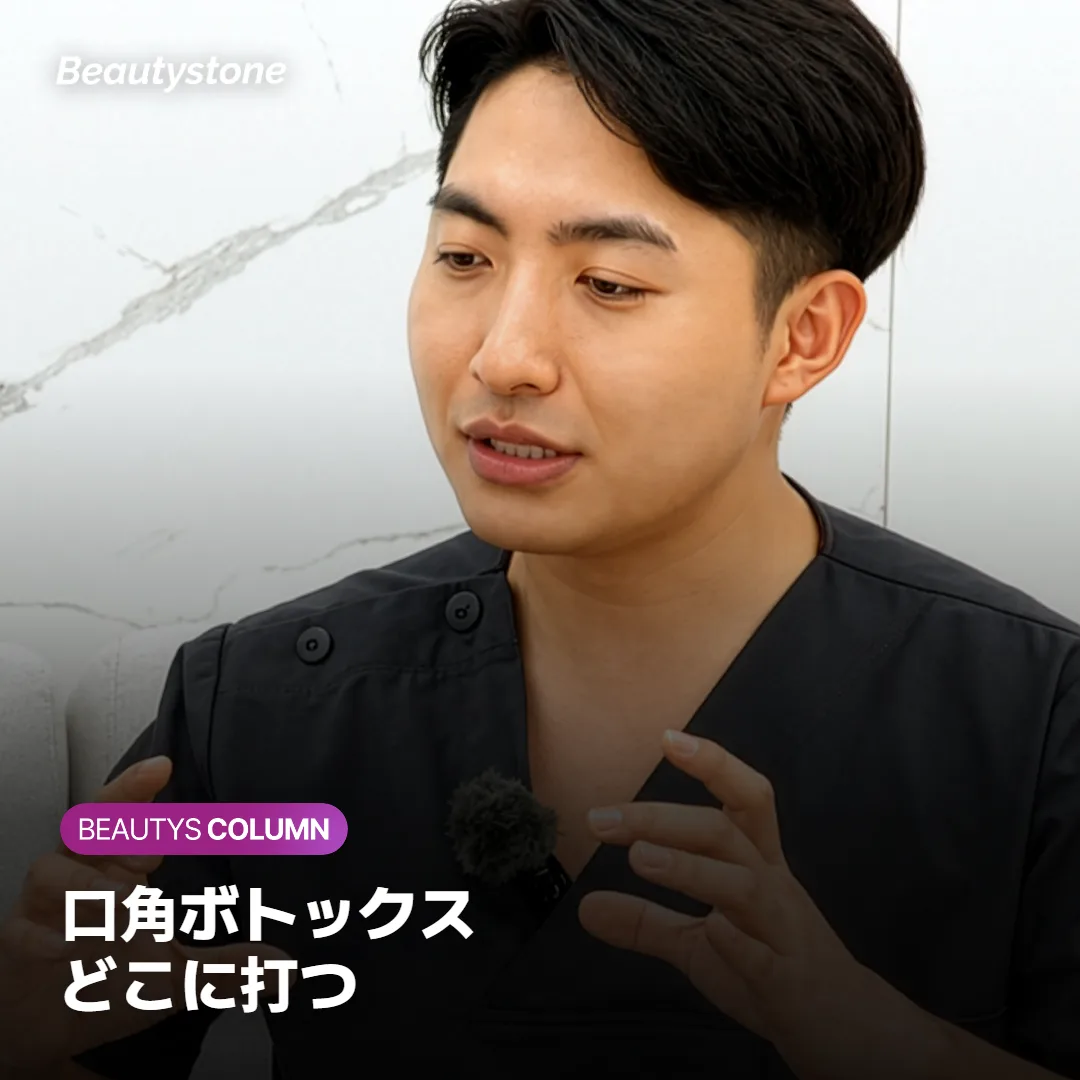 口角ボトックスはどこに打つ?口角下制筋の位置と打つ場所の注意点を解説