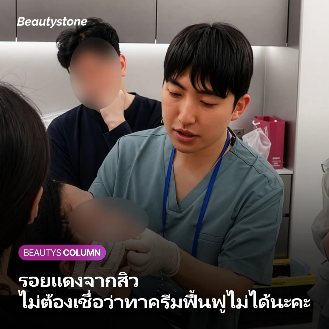 รอยแดงจากสิว ไม่ต้องเชื่อว่าทาครีมฟื้นฟูไม่ได้นะคะ