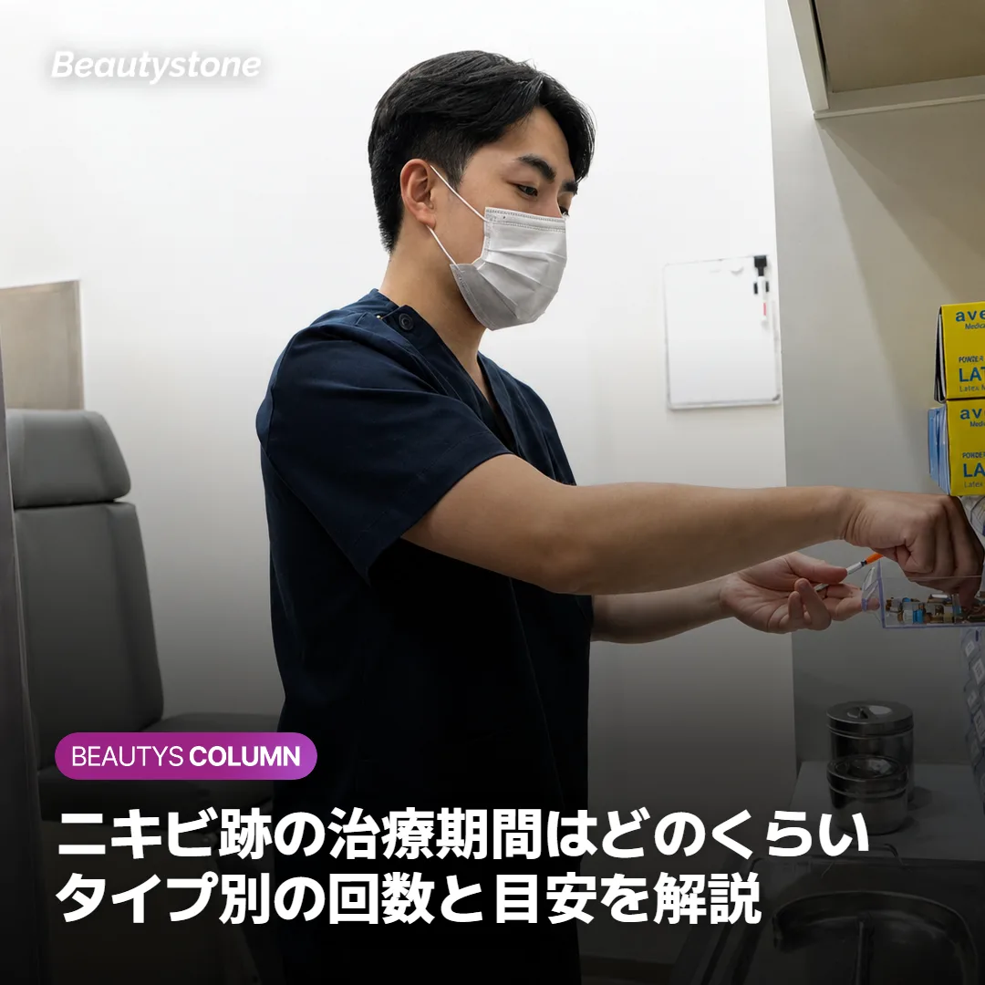 ニキビ跡の治療期間はどのくらい?タイプ別の回数と目安を解説