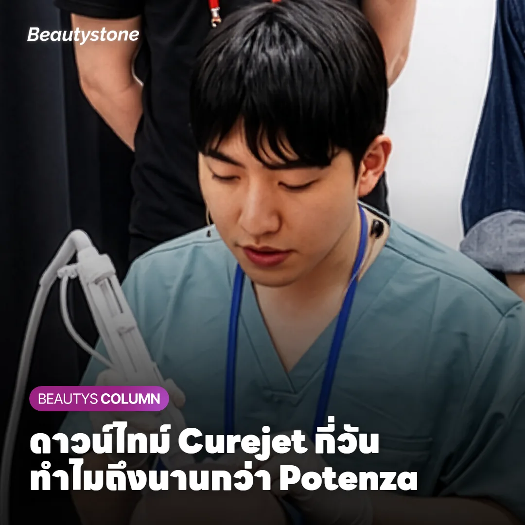 ดาวน์ไทม์ Curejet กี่วัน? ทำไมถึงนานกว่า Potenza