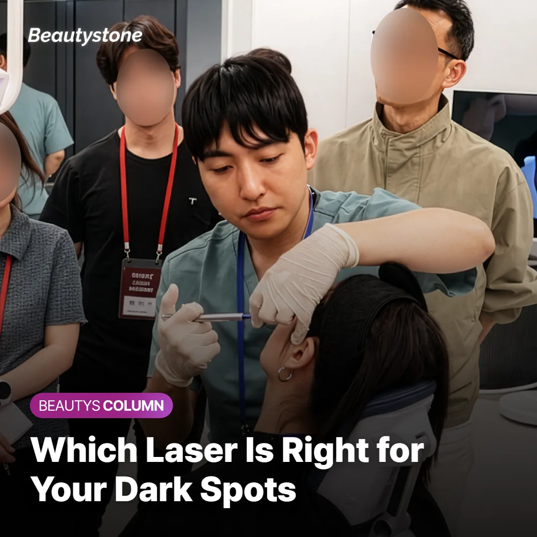 Which Laser Is Right for Your Dark Spots?