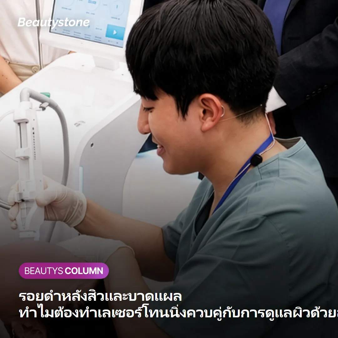 รอยดำหลังสิวและบาดแผล ทำไมต้องทำเลเซอร์โทนนิ่งควบคู่กับการดูแลผิวด้วยสารเพิ่มความกระจ่างใส?