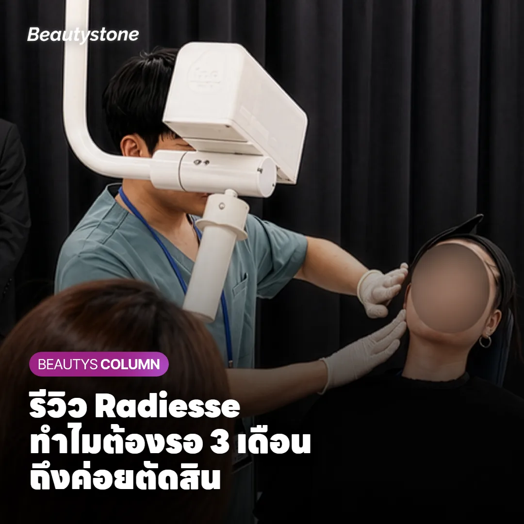 รีวิว Radiesse ทำไมต้องรอ 3 เดือนถึงค่อยตัดสิน?