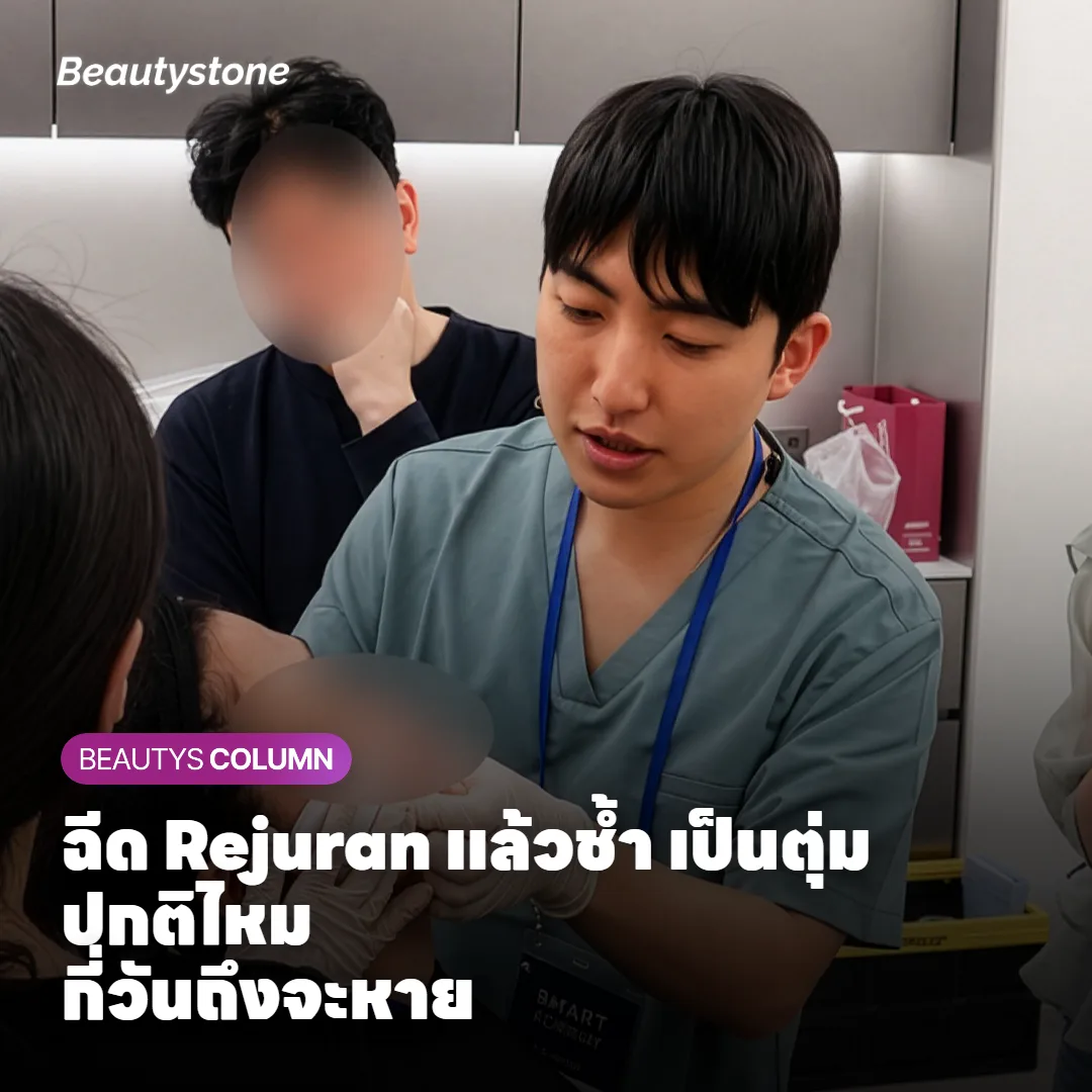 ฉีด Rejuran แล้วช้ำ เป็นตุ่ม ปกติไหม? กี่วันถึงจะหาย