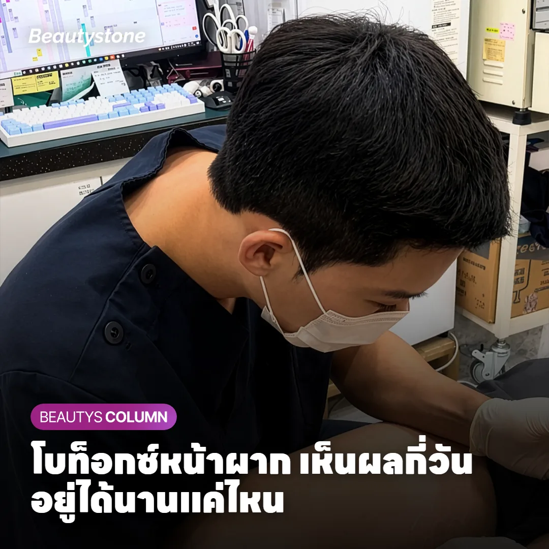 โบท็อกซ์หน้าผาก เห็นผลกี่วัน อยู่ได้นานแค่ไหน?